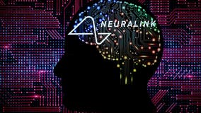 Neuralink knew for years that tiny wires in brain were an issue, Reuters says