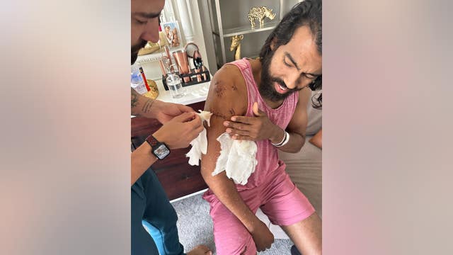 Pit bulls involved in violent attack on SF man euthanized