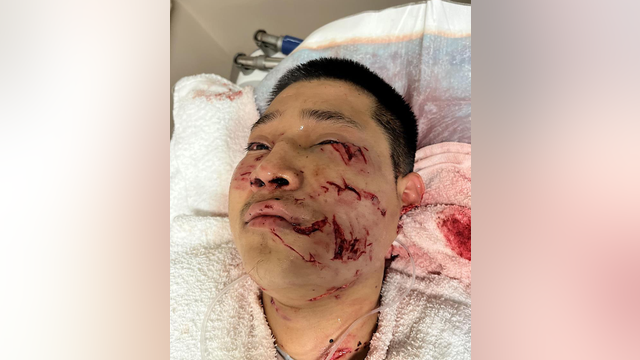 San Jose K-9 rips off man's earlobe, exclusive video shows