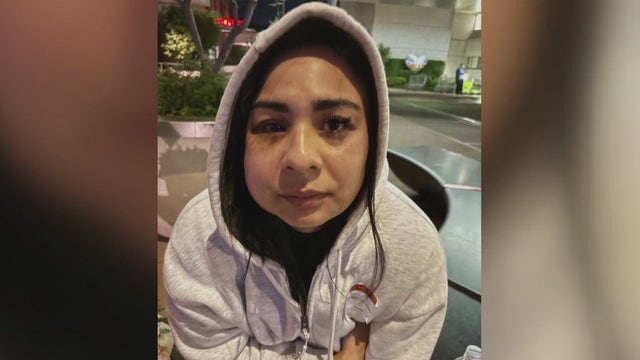 SF woman recovering after brutal Daly City attack, suspect arrested