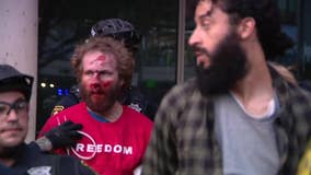 DOJ to investigate Turning Point USA protests at UC Berkeley