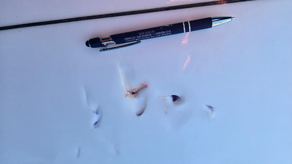 Shark bites surfer off Sonoma County coast