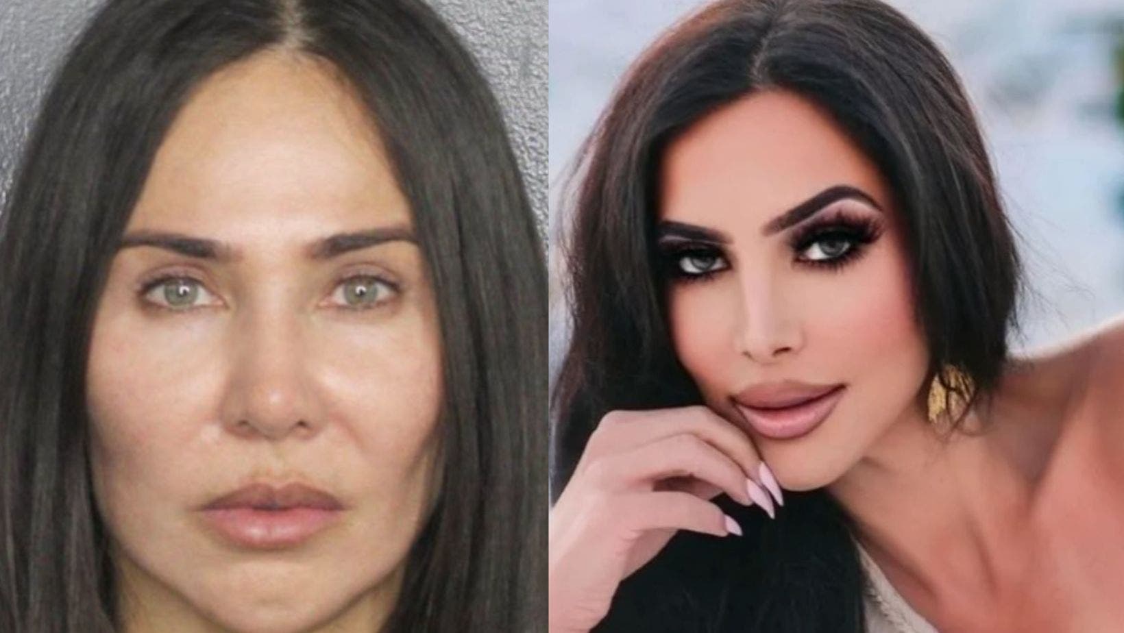 Woman convicted in fatal butt injection procedure gone wrong at Burlingame hotel