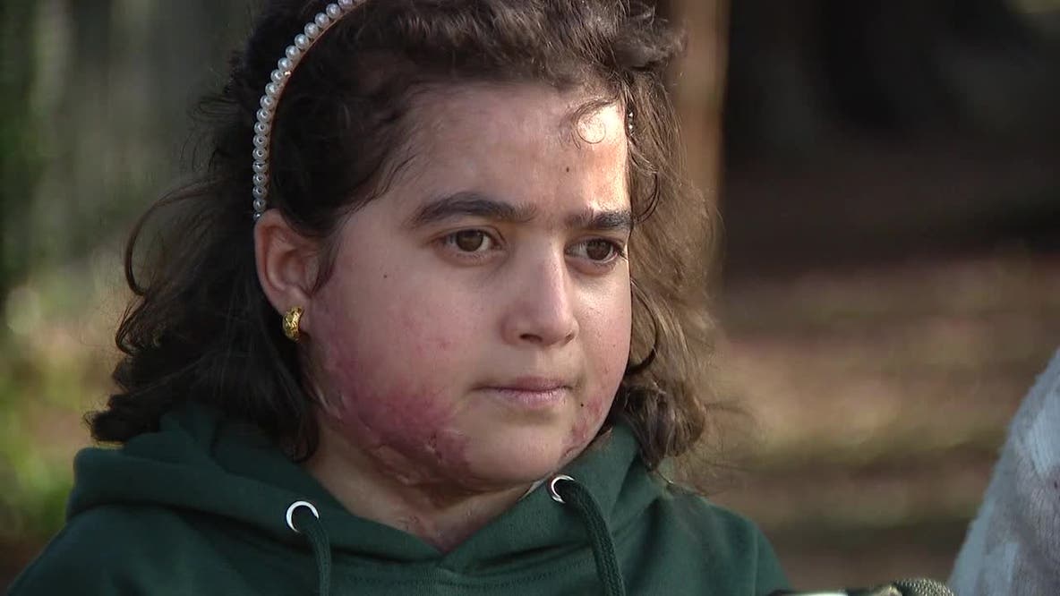 From Gaza to the Bay Area: A young girl’s journey of healing
