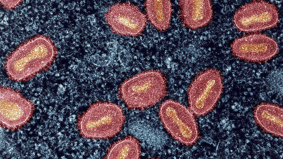 SF Department of Public Health confirms first clade I mpox case