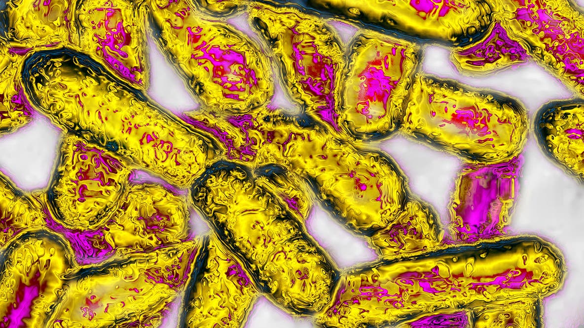 Public health officials confirm 18 Legionella infections connected to Kaiser Permanente Santa Clara
