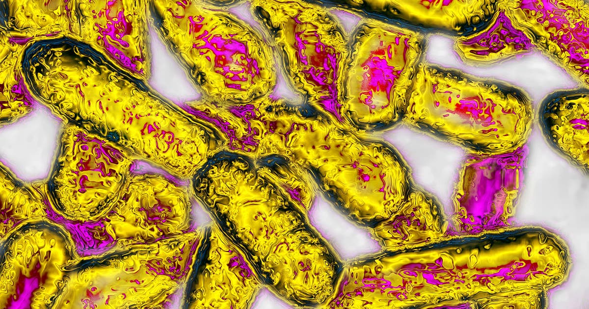 Public health officials confirm 18 Legionella infections connected to Kaiser Permanente Santa Clara