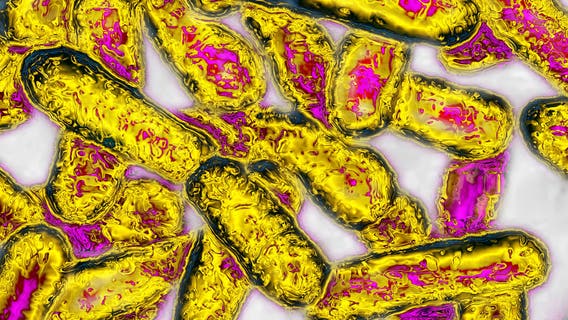 Public health officials confirm 18 Legionella infections connected to Kaiser Permanente Santa Clara