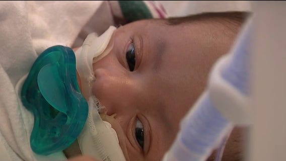 Santa Clara Valley Medical Center program tackles 'critical gap' in NICU mental health