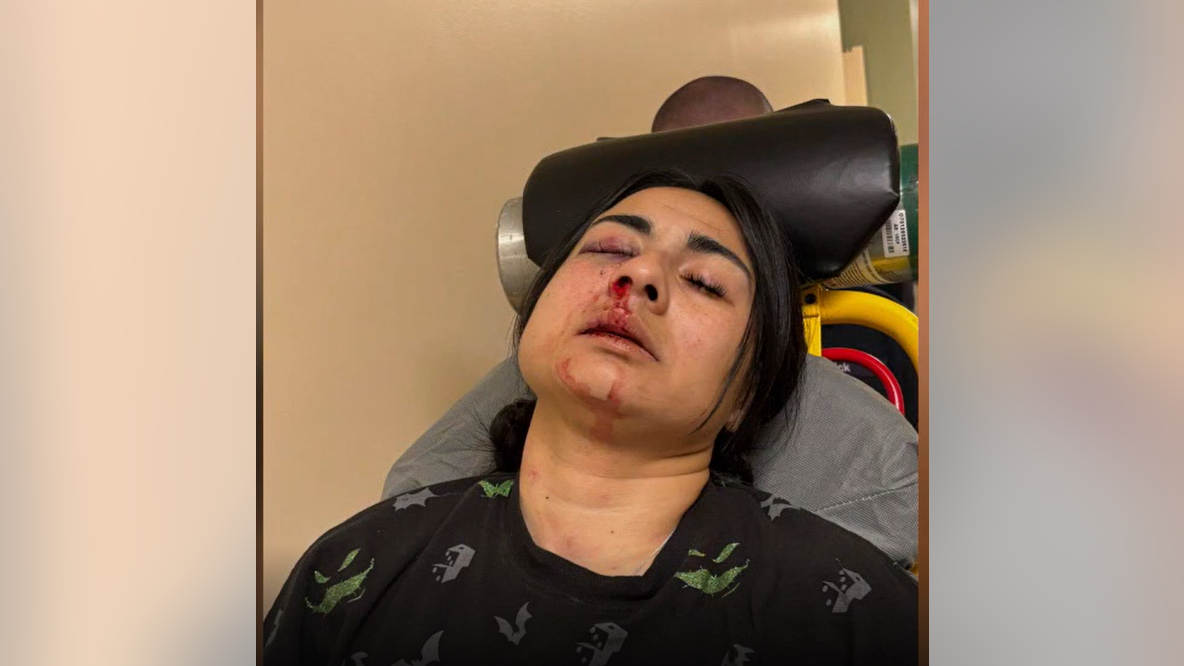 Assault victim files suit alleging property owners, security company failed to protect her