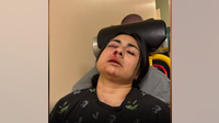 Assault victim files suit alleging property owners, security company failed to protect her