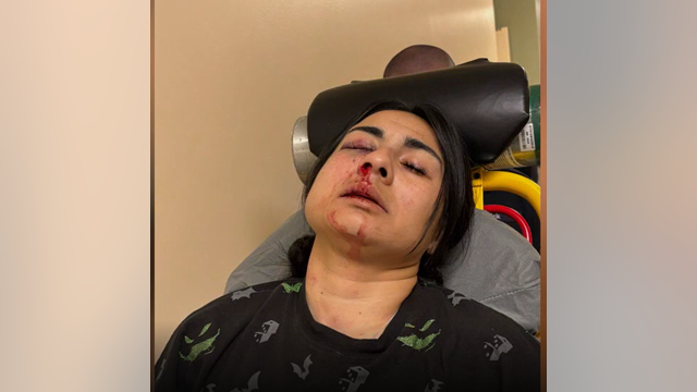 Assault victim files suit alleging property owners, security company failed to protect her