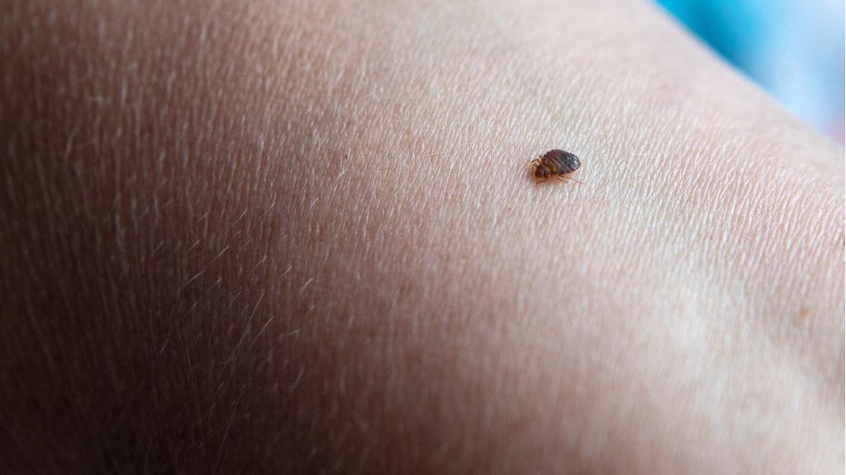 FILE - A bed bug is pictured on an arm. (Photo by Sina Schuldt/picture alliance via Getty Images)