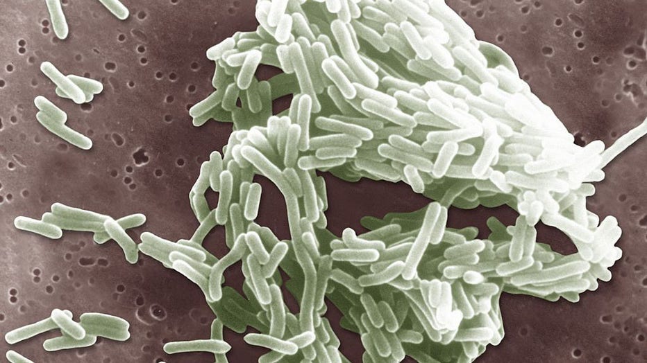 FILE - Listeria Monocytogenes. (Photo By BSIP/Universal Images Group via Getty Images)