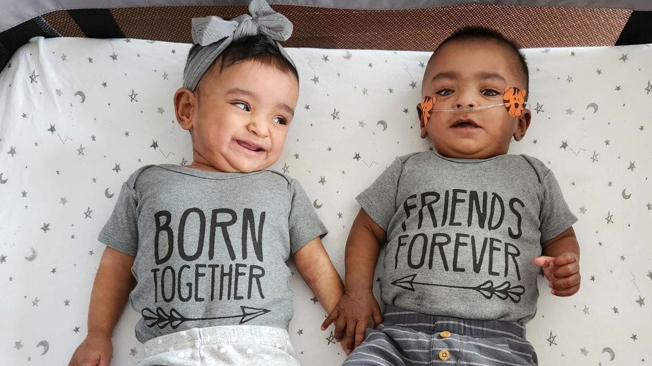 Born 4 months early, world's most premature twins celebrate their