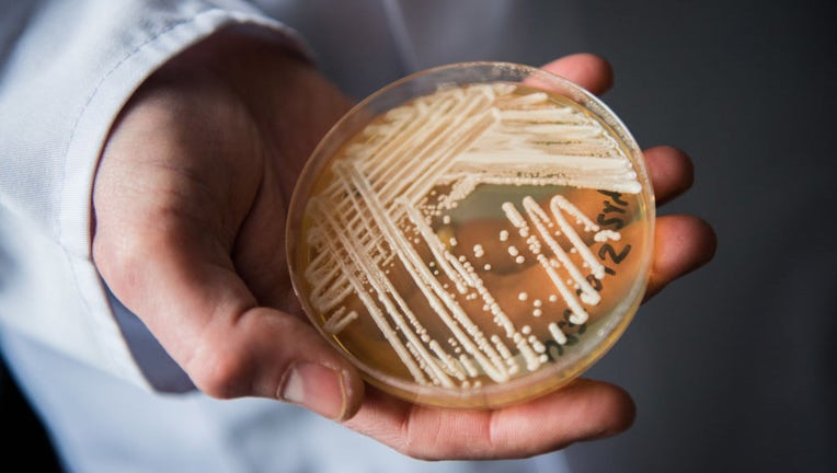 FILE - The director of the National Reference Centre for Invasive Fungus Infections holds a petri dish holding the yeast candida auris in a laboratory of Wuerzburg University in Wuerzburg, Germany, on Jan. 23, 2018. (Photo by Nicolas Armer/picture alliance via Getty Images)