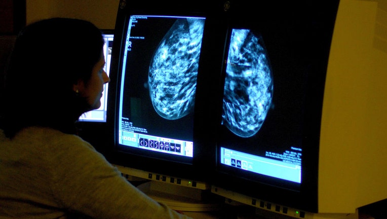 FILE - A file image shows a consultant analyzing a mammogram showing a womans breast in order check for breast cancer. (Photo by Rui Vieira - PA Images/PA Images via Getty Images)