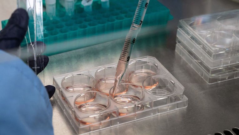 FILE - This photograph taken on Nov. 17, 2021, shows a laboratory test at the Transgene biotech firm, which is working to develop a neoantigen cancer vaccine, in Illkirch-Graffenstaden, eastern France. (Photo by PATRICK HERTZOG/AFP via Getty Images)