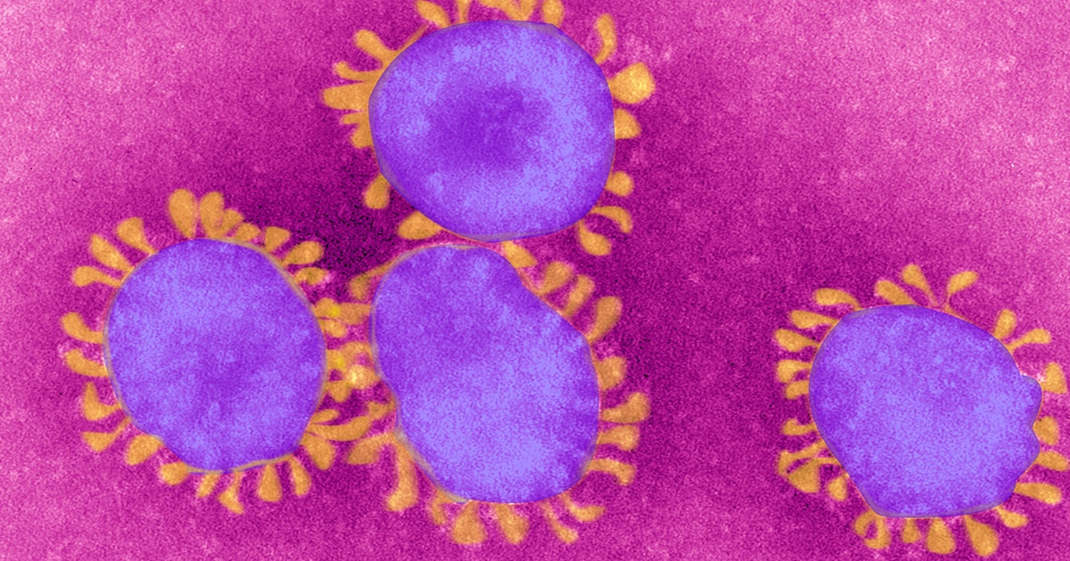 New COVID-19 variant ‘Eris’ spreads across US, other countries ...