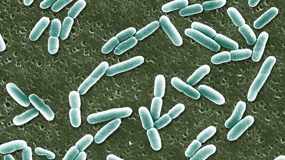 Five people hospitalized in E. coli outbreak at the University of