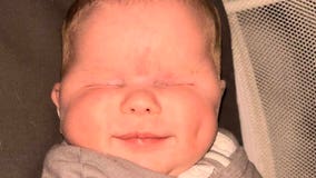 Baby born without eyes, diagnosed with rare genetic disorder