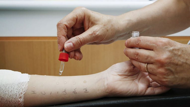 FILE - Testing for certain food allergies on a boys skin. (Photo By BSIP/Universal Images Group via Getty Images)