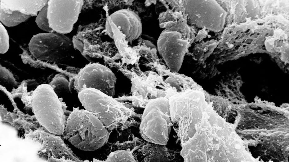 FILE - Scanning electron micrograph depicting a mass of Yersinia pestis bacteria (the cause of bubonic plague) in the foregut of the flea vector. (Photo by: IMAGE POINT FR/NIH/NIAID/BSIP/Universal Images Group via Getty Images)