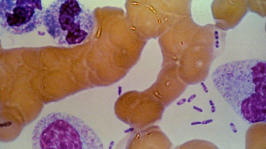 FILE - Dark stained bipolar ends of Yersinia pestis can be seen in this stain of blood from a plague victim, 1993. (Photo by Smith Collection/Gado/Getty Images).