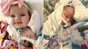 Virginia infant awaits life-saving double lung transplant at Texas Children’s