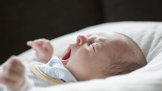 Tongue-tie in babies may be overdiagnosed and needlessly treated, AAP says
