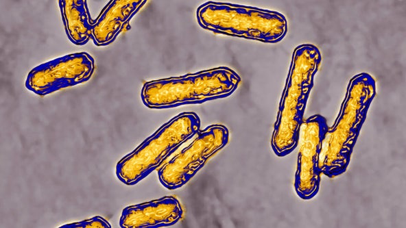 2 deaths linked to listeria outbreak, more than 2 dozen hospitalized, CDC says