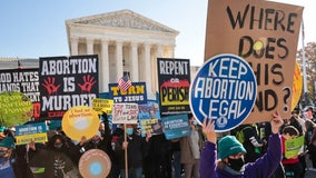 Abortion access 2024: Here’s where the laws stand in your state