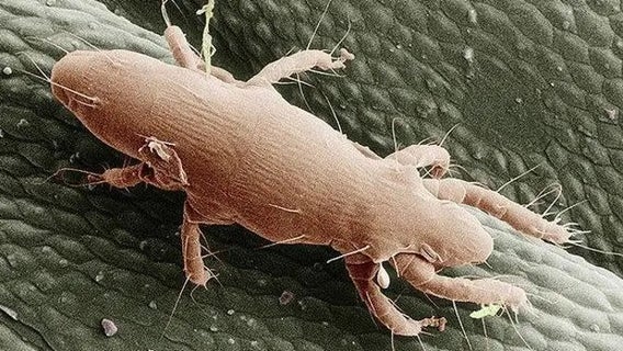 Mysterious bug bites could be from mites feeding on cicada eggs