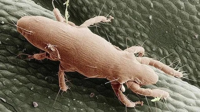 Mysterious bug bites could be from mites feeding on cicada eggs