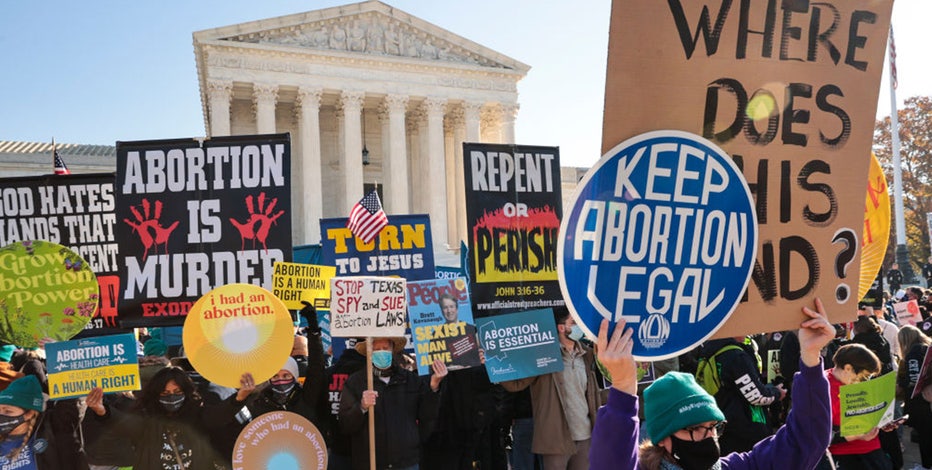 Abortion access 2024: Here’s where the laws stand in your state