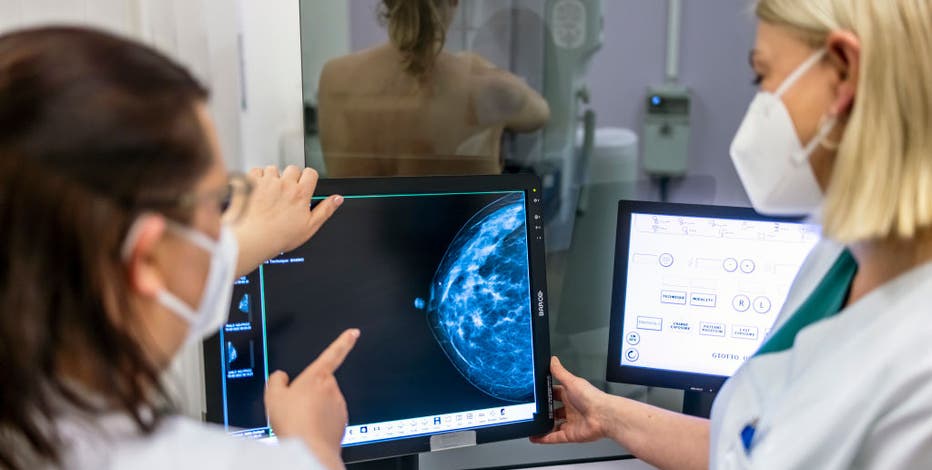 Breast cancer deaths down, but cases up — especially in younger women
