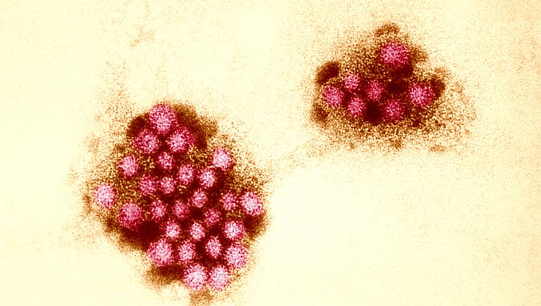 Norovirus outbreaks surge throughout US: What you wish to have to understand