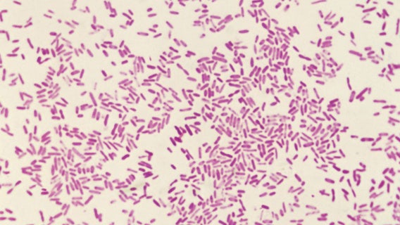 Oregon dysentery outbreak: 7 new cases reported in February so far