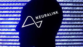 3rd Neuralink brain implant patient able to communicate despite non-verbal ALS