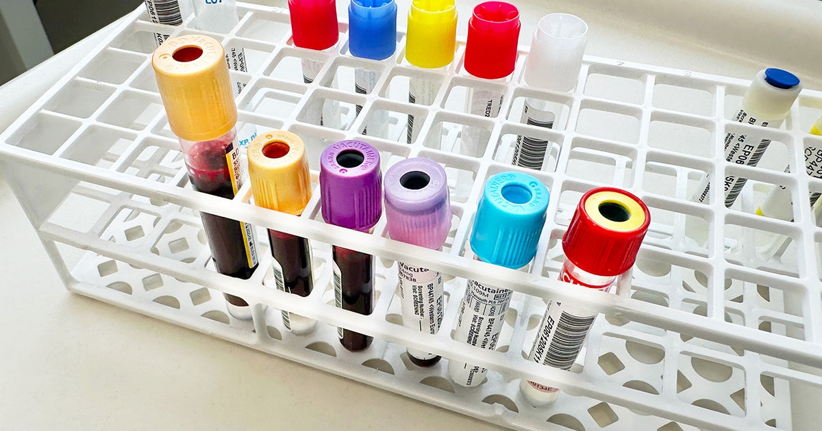 Cancer could be detected three years before diagnosis with experimental ...