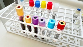 Cancer could be detected three years before diagnosis with experimental blood test