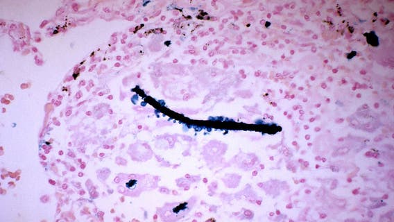 Is Trump reversing a Biden-era asbestos ban? Here’s what we know