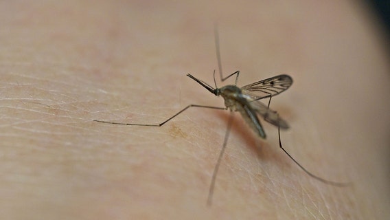 Here's what makes you a prime target for mosquitoes