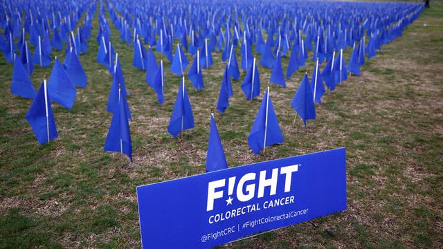 Exercise cuts colon cancer recurrence, boosts survival, study finds