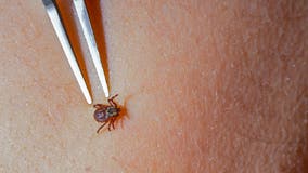 ER visits for tick bites are at their highest level in years: Here's where