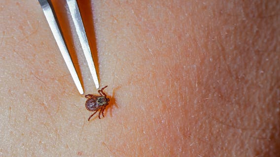 ER visits for tick bites are at their highest level in years: Here's where