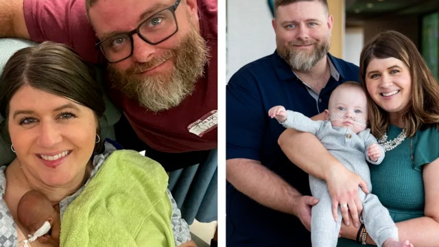 World's most premature baby defies all medical odds to reach 1st birthday