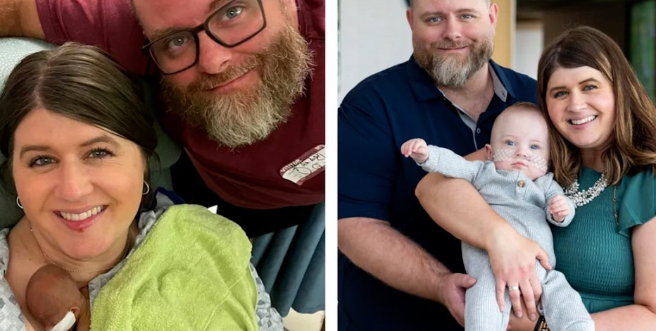 World's most premature baby defies all medical odds to reach 1st birthday