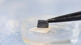 At-home skin cancer test could be one step closer