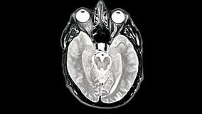 SuperAgers over 80 show memory equal to adults in their 50s, study finds